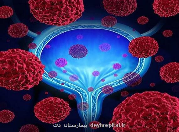 مهم ترین عوامل ایجاد سرطان مثانه